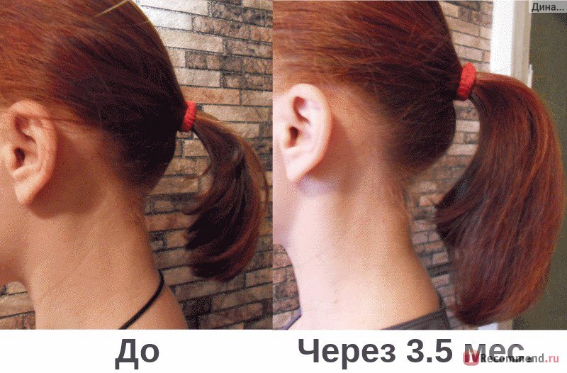 QO7FnwfqpdACwB0Jp7QuywgHVL9HJJ5V42q