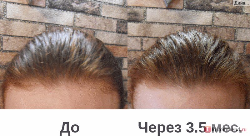 ozAK5o05UlktWcppw4WIwDba1MllnIgIzv